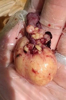 Ovary-Testicle